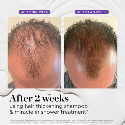 MyHairGroot. Miracle in Shower Treatment